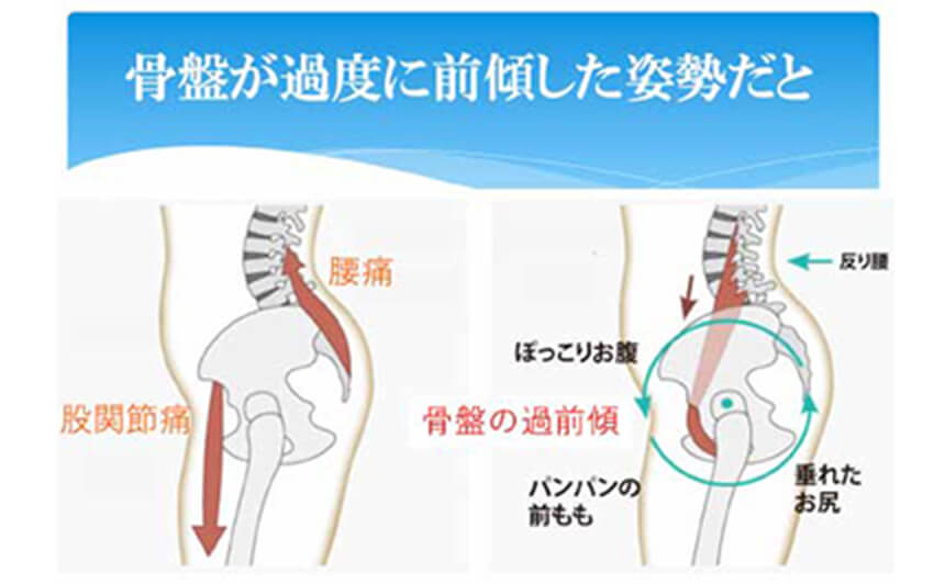 骨盤強化編(筋肉トレーニング、ストレッチ、姿勢改善)