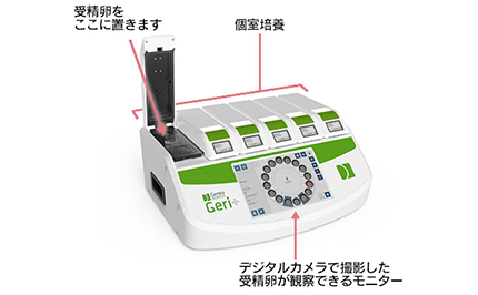 培養器 受精卵を育てる最も大切な機器です。 出来るだけ女性の体内と同じ環境になるように温度、ガス濃度がコンピューターで設定されています。 患者さんごとに受精卵を器械内の別々の場所で培養(個室培養)することにより、極力、受精卵を空気に触れさせないようにしています。 受精卵はできるだけ空気に触れない方がいいため、当院はすべて個室培養を行っています。 たとえばAさんの受精卵を培養器から取り出すときに、個室培養ならBさんの受精卵は空気に触れることがありません。 また培養器には最新の「タイムラプス培養器(Geri)」を導入しています。 タイムラプス培養器にはデジタルカメラが内蔵されているため、受精卵を培養器から取り出さずに(空気に触れさせず)、受精卵の観察が可能となっています。