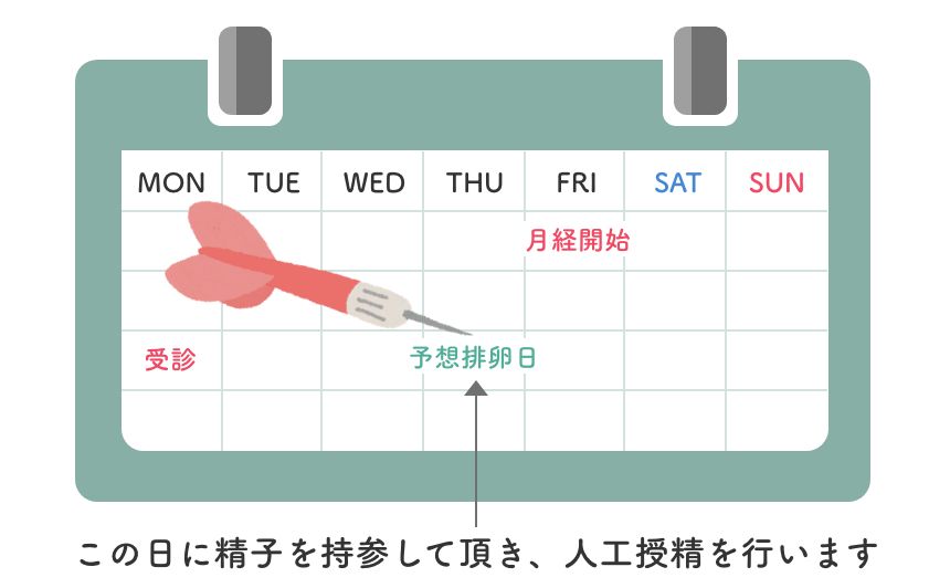 排卵日前にあらかじめ受診していただき、排卵日を予測します。 お薬を使わずに自然排卵で行う場合もありますし、排卵が不規則な方は排卵誘発剤を使用しながら行う場合もあります。 排卵予想日に精子をお持ちいただき、精子を洗浄してから人工授精を行います。 洗浄には約1時間、子宮の中に精子を入れる処置は3分程で終了します。 痛みはほとんどありません。