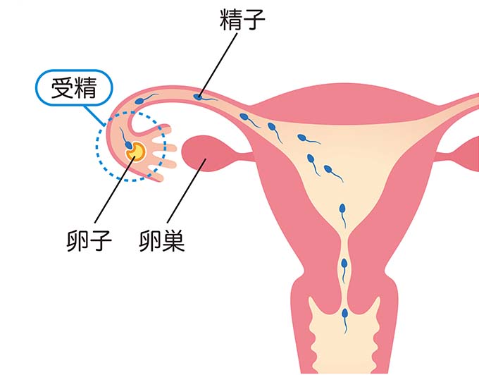 人工授精を受けた方がいい患者さま 精子検査で正常値を下回った患者さんは、精子が子宮の中に到達できていない可能性があります。 人工授精で精子を子宮に送り込むことで妊娠を期待します。 この手法はとても単純な理屈で、精子をできるだけ卵管の中の卵子に｢近づける｣ことで妊娠を期待するものです。 子宮の中に入れた精子は通常の性交と同様、卵管の中の卵子まで泳いでいくという点で、自然妊娠と同じメカニズムで妊娠が成立します。人工授精で妊娠される患者さんのほとんどが4～6ヵ月以内に妊娠されます。 しかし6ヵ月行っても妊娠されない場合は人工授精では妊娠が難しいと、統計データ上で明らかになっています。 6ヵ月行っても妊娠されない場合は、体外受精へ治療を進める必要があるかもしれません。